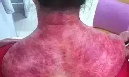 肩颈,颈肩腰腿痛穴位