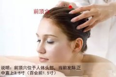 前顶穴位准确位置图和作用