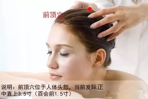 前顶穴