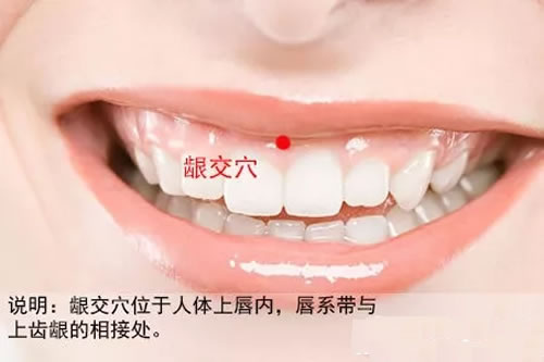 龈交穴