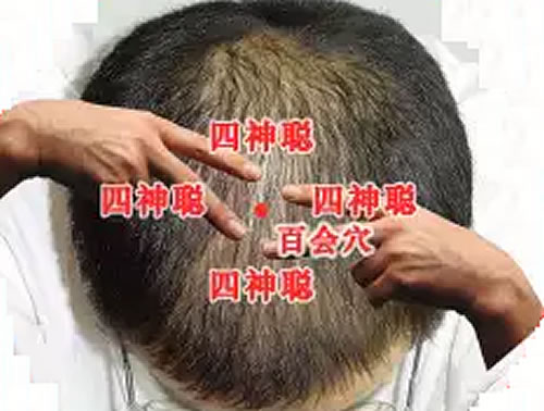 四神聪定位
