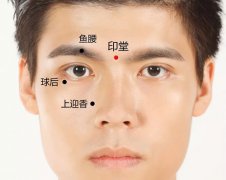 眉心穴印堂穴在哪里