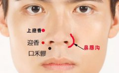 上迎香穴准确穴位图和功效作用