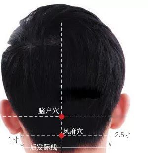 脑户穴准确穴位图及作用