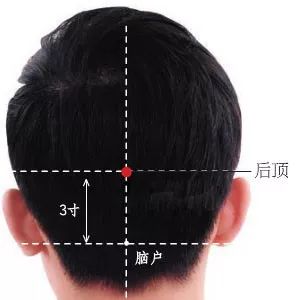 后顶穴