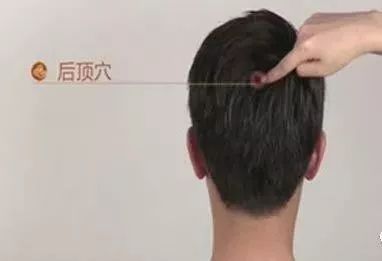 后顶穴位的作用 