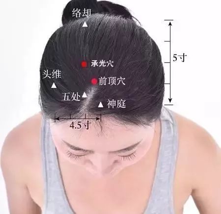 前顶穴位的作用  