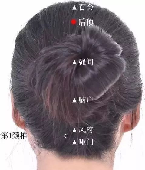 哑门穴