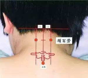 颈百劳穴