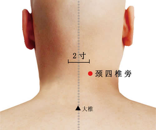 颈四椎旁穴的准确穴位图