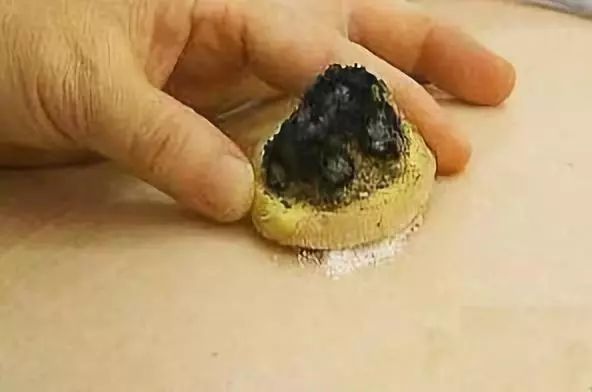 神阙穴的功效作用
