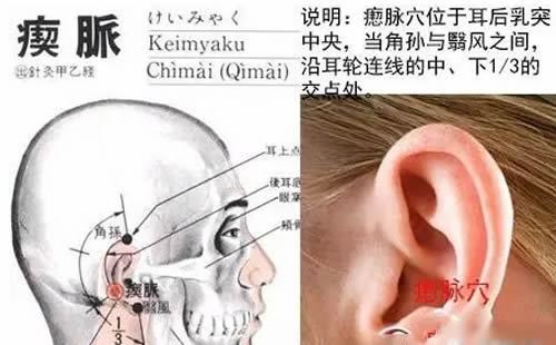 瘈脉穴的作用