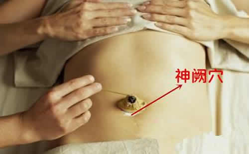 小儿重舌艾灸图片
