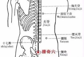 腰奇穴的准确穴位图及功效作用