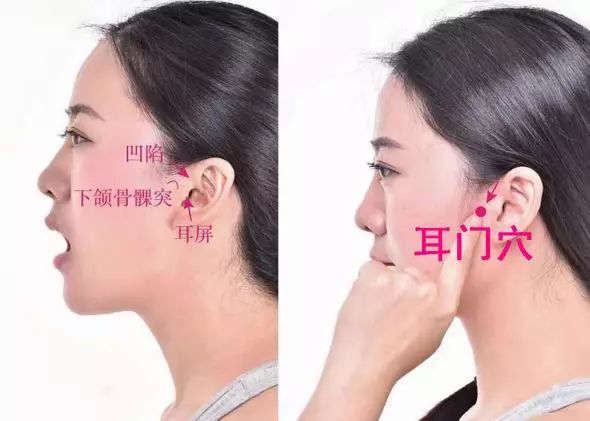 耳门穴的准确穴位图及作用