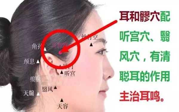 耳和髎的准确穴位图