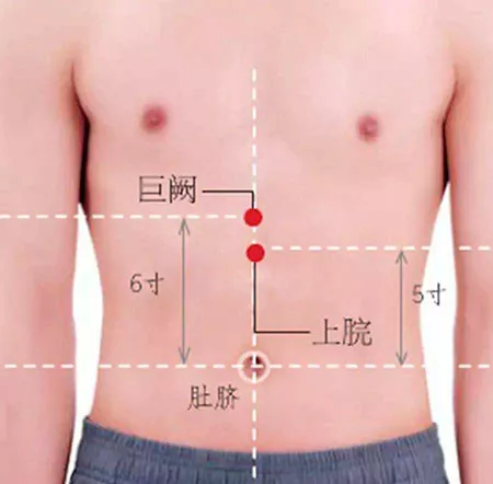 上脘穴的准确穴位图及作用