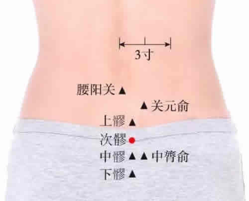 次髎穴的准确穴位图及作用