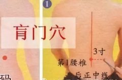 <b>肓门穴的准确穴位图及作用</b>