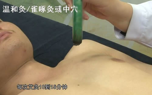 彧中穴的准确位置图