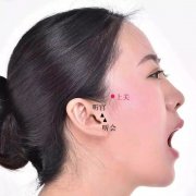 上关穴的准确穴位图及作用