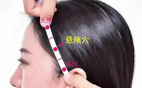 悬颅穴的准确穴位图及作用