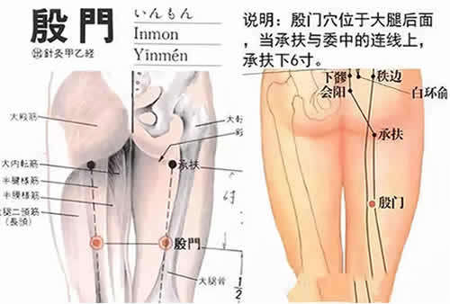 殷门穴的准确穴位图及功效作用