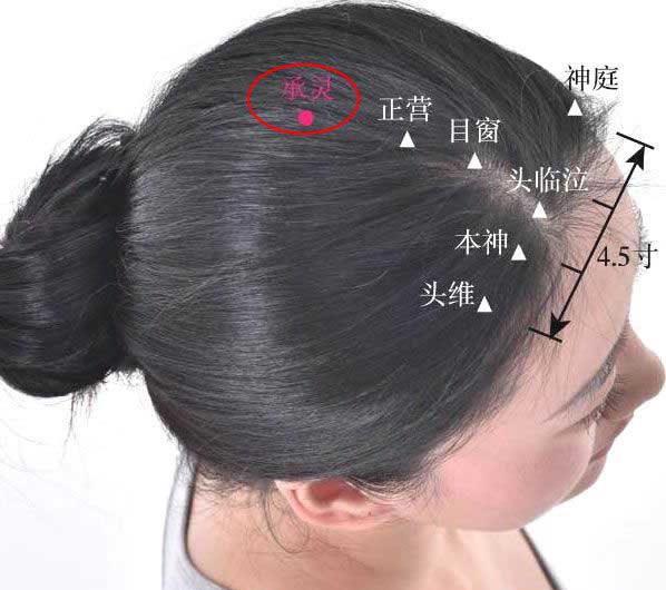 承灵穴