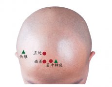 曲差穴