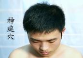 艾灸疗法