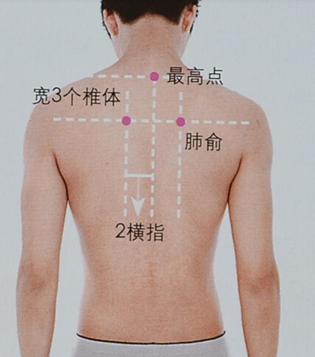 艾灸疗法