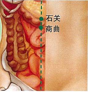 石关穴的准确穴位图及作用