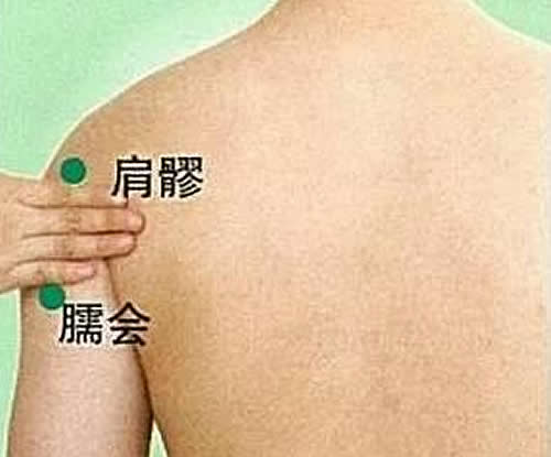 臑会穴的准确穴位图及作用