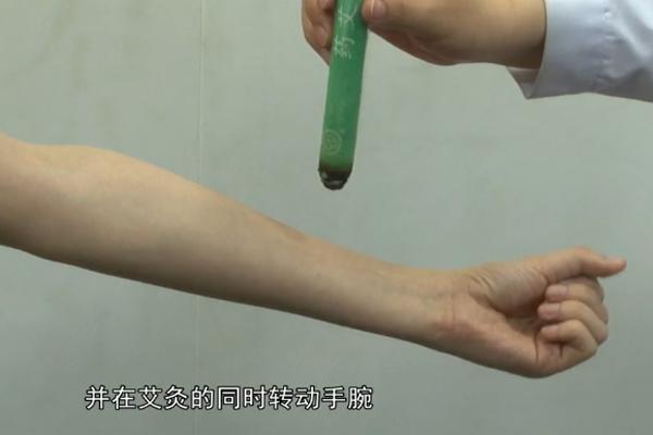 郗门穴的准确穴位图