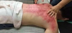 经络是管什么的,快看看吧!