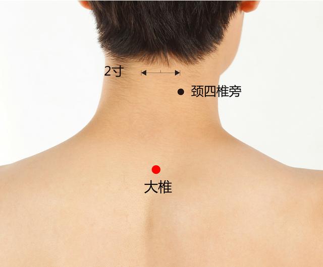 大椎穴