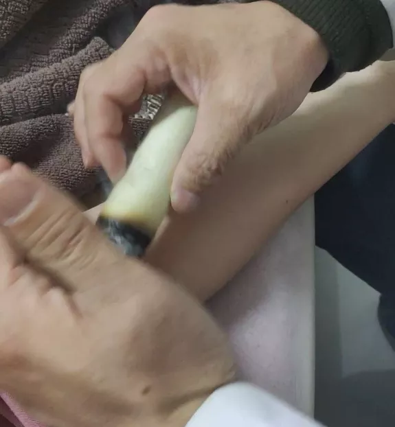 循环灸
