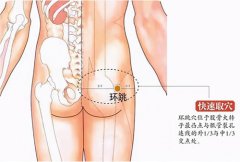 从肌论穴,环跳穴:腰痛必治臀,息事又宁人