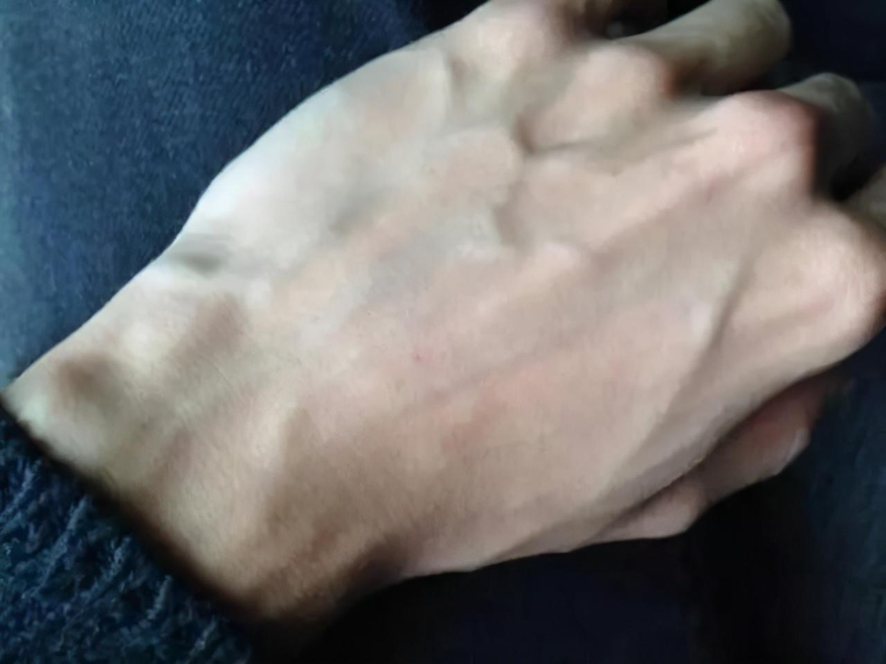 青筋