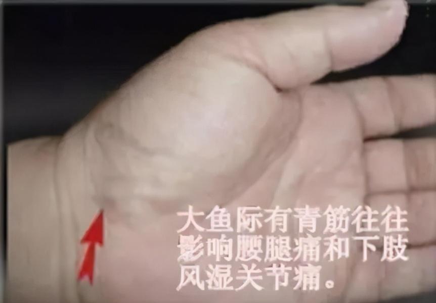 手掌青筋