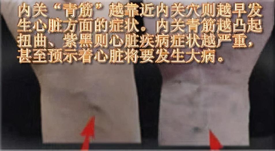 青筋