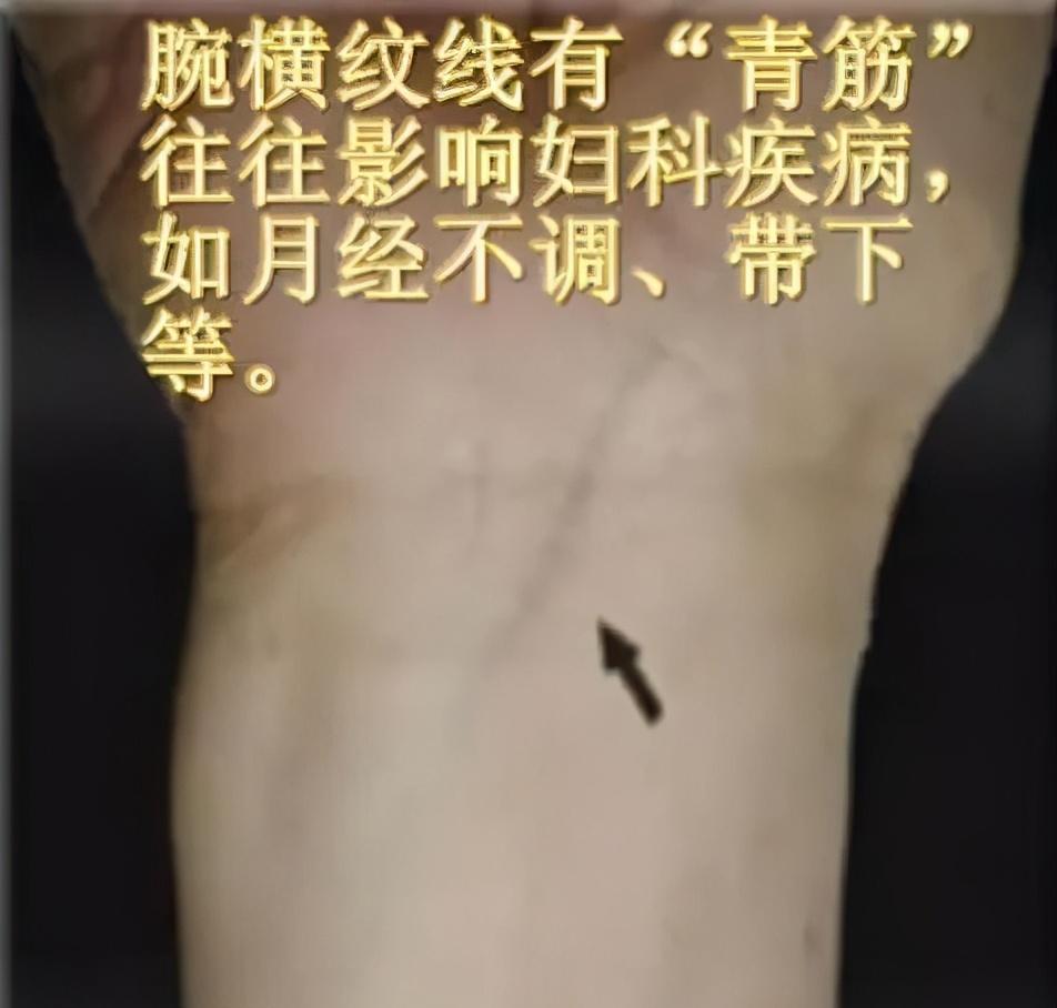 青筋
