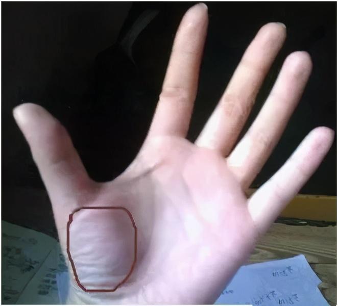 大鱼际诊法:手掌上这块肉,一看就知道你身体好不好!