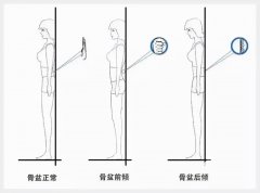 跷二郎腿的危害大,一直跷离疾病不远了！
