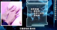 乳腺癌的15个征兆,早知道早预防！